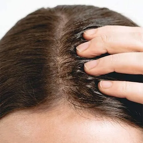 THE ORDINARY

Multi-Peptide Serum For Hair Density 60ml